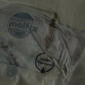 Bebek Bezinde Şok Edici Hata