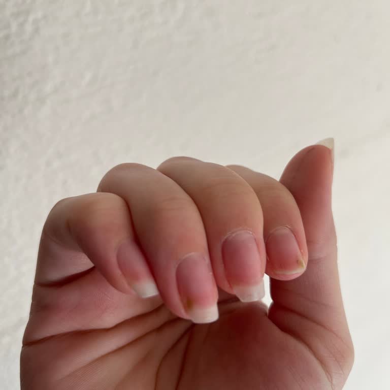 Mybest Beauty Memnuniyetsizliği