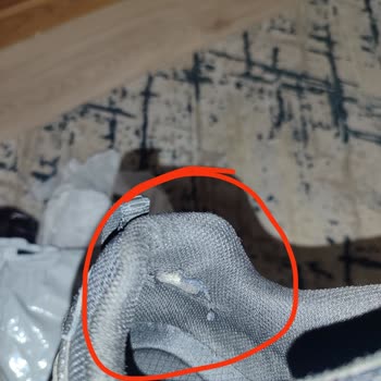 Skechers Ayakkabıda Tek Taraflı Yıpranma Ve İade Sorunu