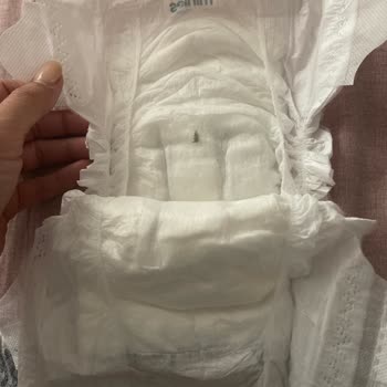 Bebek Bezinde Böcek Şoku: Hijyen Skandalı!