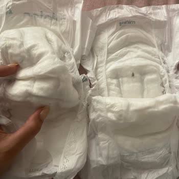 Bebek Bezinde Böcek Şoku: Hijyen Skandalı!