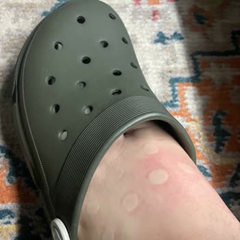 Ceyo Yanlış Beden Sorunu Ve İade Sürecinde Zorluk