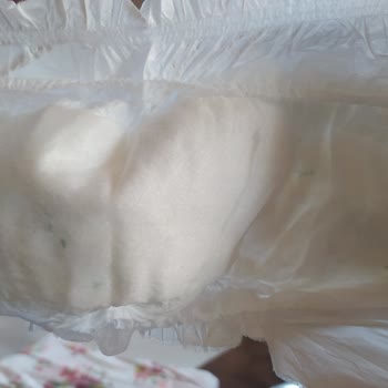 Sleepy Çocuk Bezlerinde Gizemli Katı Madde Sorunu