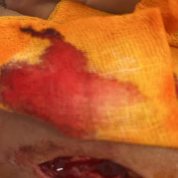 Yanlış Tedavi Sonucu Çekilen Acılar Ve Ameliyatlar