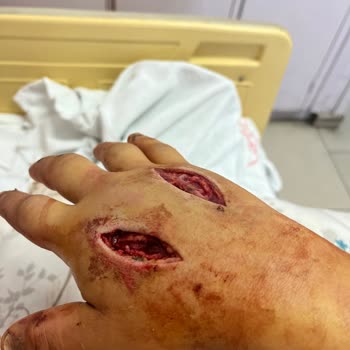 Yanlış Tedavi Sonucu Çekilen Acılar Ve Ameliyatlar