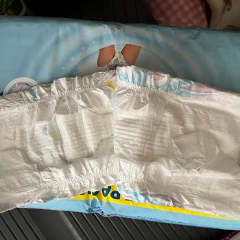 Molfix Bebek Bezinde Sızdırma Ve Kızarıklık Sorunu