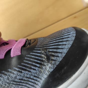 Skechers Ayakkabının Hızla Deformasyonu Ve Yetersiz Müşteri Desteği