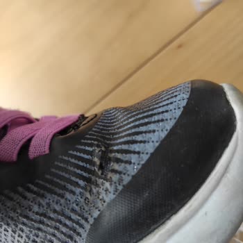 Skechers Ayakkabının Hızla Deformasyonu Ve Yetersiz Müşteri Desteği