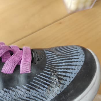 Skechers Ayakkabının Hızla Deformasyonu Ve Yetersiz Müşteri Desteği