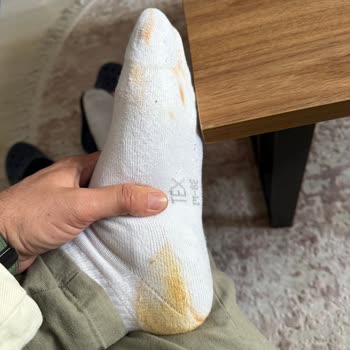 Derimod Ayakkabı Renk Değiştirme Sorunu