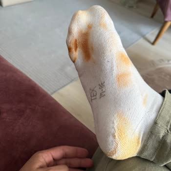 Derimod Ayakkabı Renk Değiştirme Sorunu
