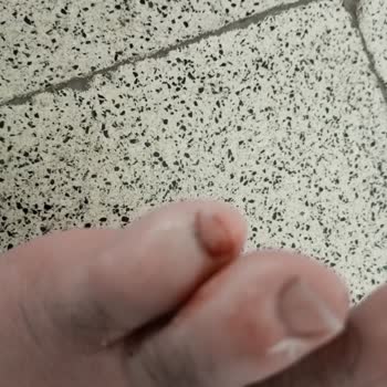 Aronay Ayakkabı Kalitesizliği