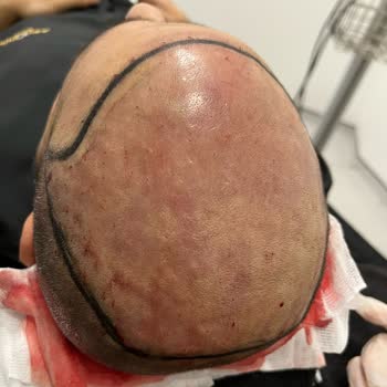 Aslı Tarcan Saç Ekim Merkezi'nde Hayal Kırıklığı