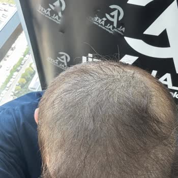 Celal Akfil Saç Gölgelendirme Merkezi Saç Renk Değişimi Ve Sürekli İşlem Gereksinimi