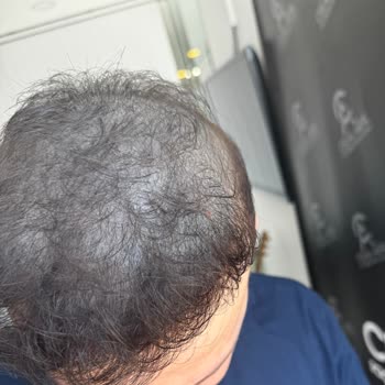 Celal Akfil Saç Gölgelendirme Merkezi Saç Renk Değişimi Ve Sürekli İşlem Gereksinimi