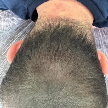 Celal Akfil Saç Gölgelendirme Merkezi Saç Renk Değişimi Ve Sürekli İşlem Gereksinimi