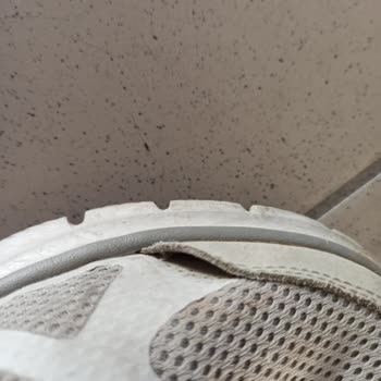 My Skechers Shoes Tore After 5 Months and Weren’t Replaced