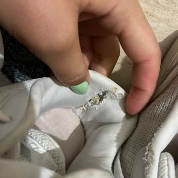 My Skechers Shoes Fell Apart After One Season of Use