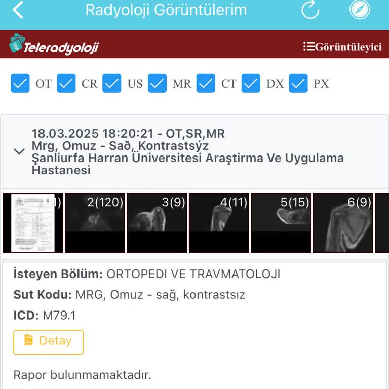 Üniversite Hastanesinde MR Raporu Gecikmesi Ve Kötü Muamele