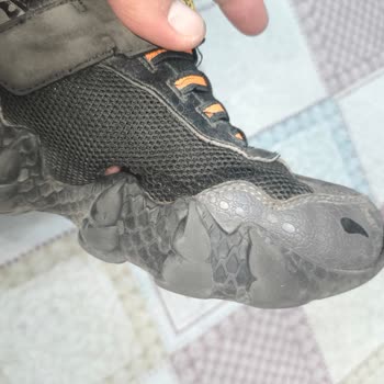Skechers Ayakkabıda Erken Yıpranma Ve Müşteri Suçlaması