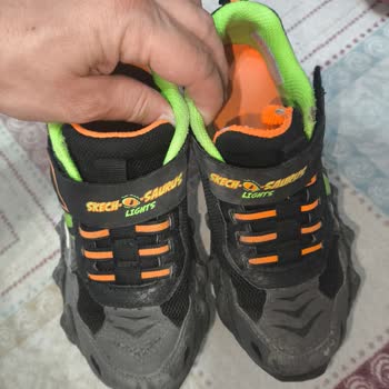 Skechers Ayakkabıda Erken Yıpranma Ve Müşteri Suçlaması