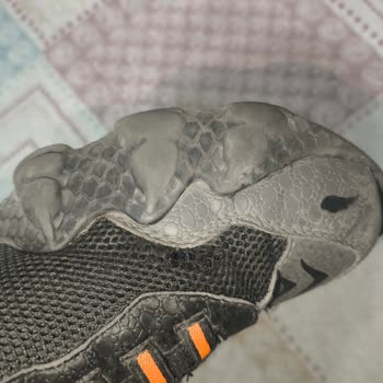 Skechers Ayakkabıda Erken Yıpranma Ve Müşteri Suçlaması