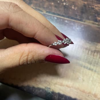 Atasay'dan Gelen Deforme Yüzük Ve İlgisizlik