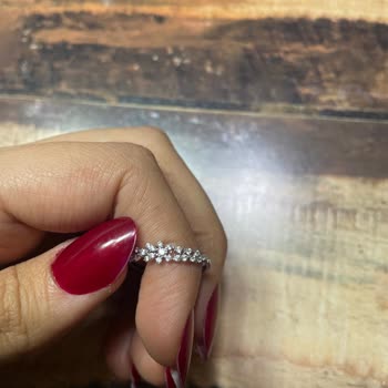 Atasay'dan Gelen Deforme Yüzük Ve İlgisizlik