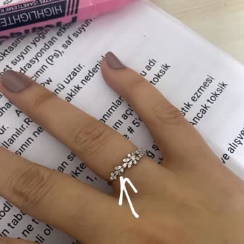 Atasay'dan Gelen Deforme Yüzük Ve İlgisizlik