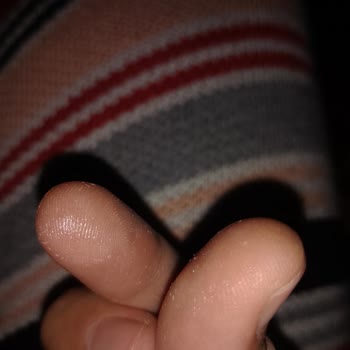 Celenes Güneş Kremi: Ciltte Yanma Ve Pütürlü Yapı Sorunu