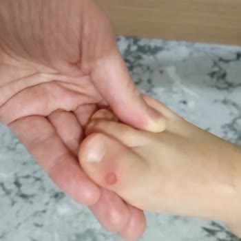 Ortopedik Ayakkabı Yarası: Deichmann Deneyimi