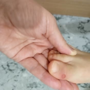 Ortopedik Ayakkabı Yarası: Deichmann Deneyimi