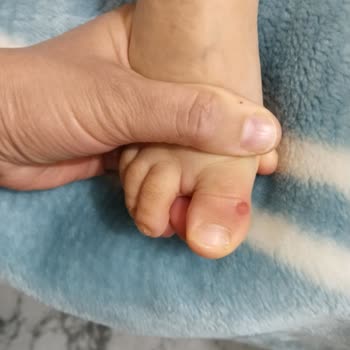 Ortopedik Ayakkabı Yarası: Deichmann Deneyimi