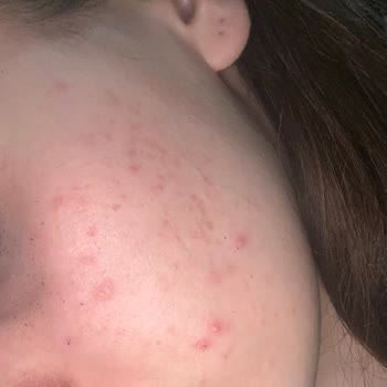 Kuaför Deneyimim ve Beklentilerim