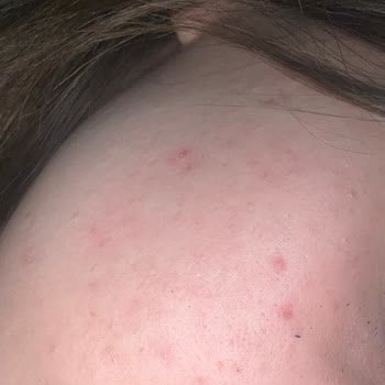 Kuaför Deneyimim ve Beklentilerim