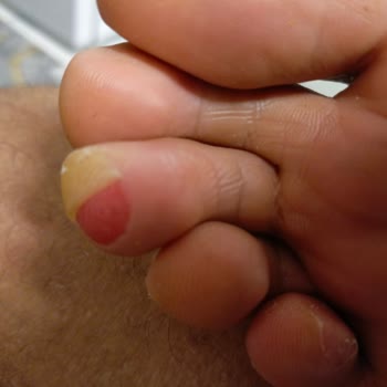 Mizuno Monarcida Neo 2 Cleats Hurt My Feet After Two Games