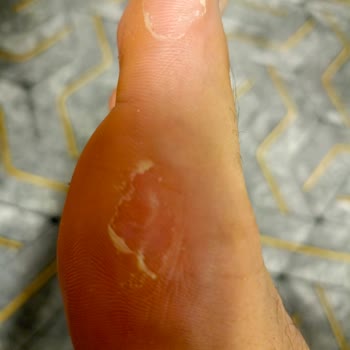 Mizuno Monarcida Neo 2 Cleats Hurt My Feet After Two Games