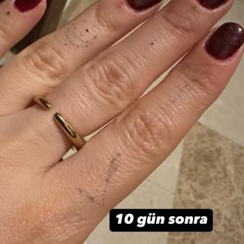 Xx Tattoo Gallery Fazlasıyla Pişman Olduğum Bir Deneyim Yaşadım