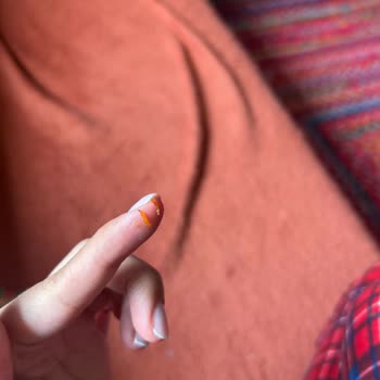 Kuru İncirde Ölü Kurt Larvaları Şoku