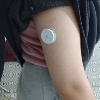 Libre 1 Sensöründe Geçersiz Sensör Sorunu Ve Müşteri Hizmetleri Desteği