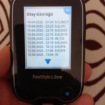 Libre 1 Sensöründe Geçersiz Sensör Sorunu Ve Müşteri Hizmetleri Desteği