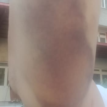 Türk Kızılay İzmir Kan Bağışında Profesyonellik Eksikliği