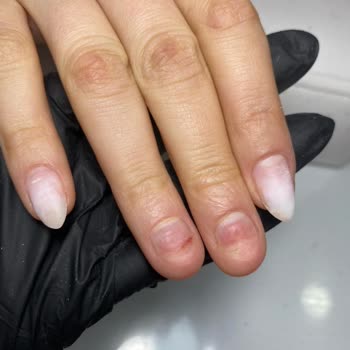 Ümitköy Şubesinde Tırnak Bakımı Sonrası Sağlık Sorunu