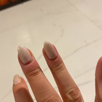 Ümitköy Şubesinde Tırnak Bakımı Sonrası Sağlık Sorunu