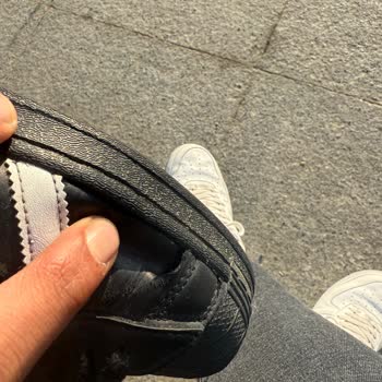 Adidas Ayakkabımın Patlaması Ve Müşteri Hizmetleri Sorunu