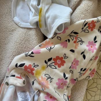 Minies Bebek Bezi Hayal Kırıklığı: Sürekli Taşırma Sorunu