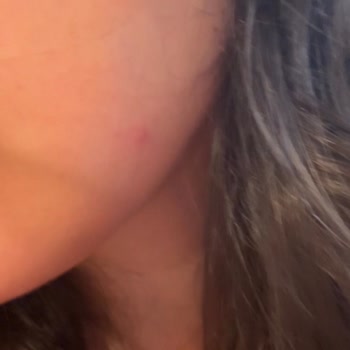 Cilt Ürünleri Yüzünden Sağlık Sorunları Yaşadım