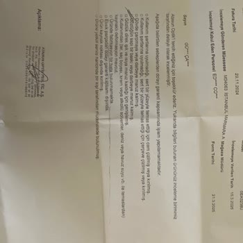 Armani Gözlüklerde Şaşırtıcı Hızda Deformasyon