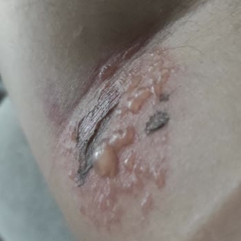 Hatalı Müdahale Sonucu Kalıcı İz Ve Güven Kaybı