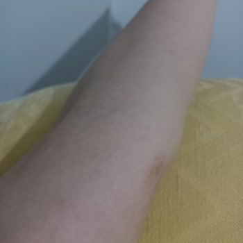 Benri Duş Jeli Ciddi Alerjiye Sebep Oldu